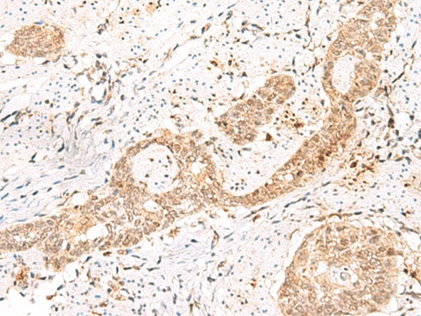 PRKAG2 Polyclonal Antibody (E-AB-52889)