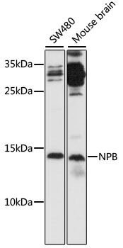 NPB Polyclonal Antibody (E-AB-91594)
