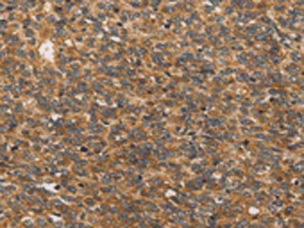 XPR1 Polyclonal Antibody (E-AB-53210)