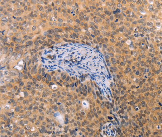 pVHL Polyclonal Antibody (E-AB-10671)