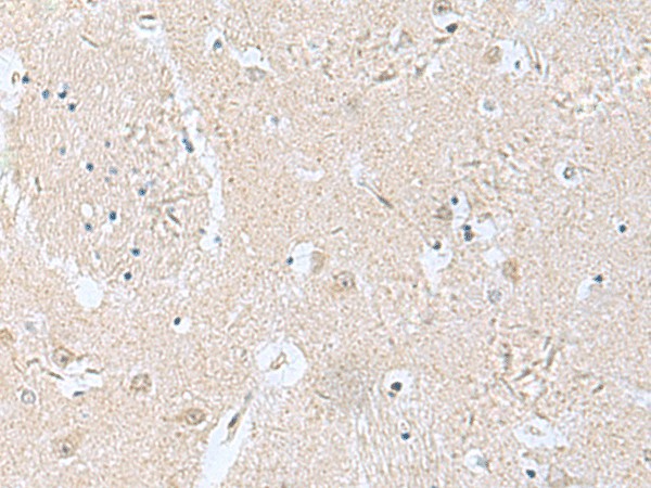 TPD52L3 Polyclonal Antibody (E-AB-19119)