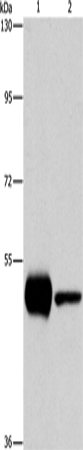 PIP4K2A Polyclonal Antibody (E-AB-14739)