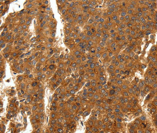 SCN11A Polyclonal Antibody (E-AB-16054)