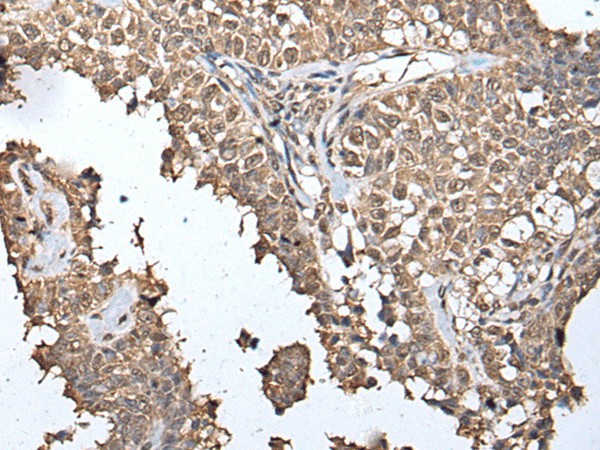 METAP1D Polyclonal Antibody (E-AB-18367)