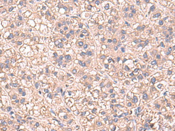 SARS Polyclonal Antibody (E-AB-52983)