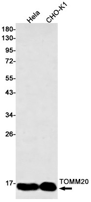 Recombinant TOMM20 Monoclonal Antibody (E-AB-81488)