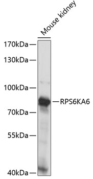 RPS6KA6 Polyclonal Antibody (E-AB-66362)