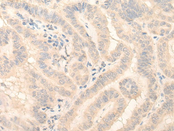 HMBS Polyclonal Antibody (E-AB-52611)