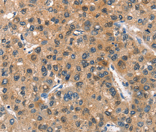 ASB2 Polyclonal Antibody (E-AB-14771)