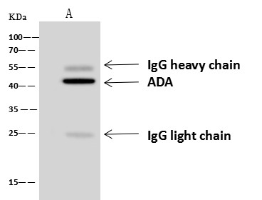 Adenosine Deaminase Monoclonal Antibody (AN200057P)
