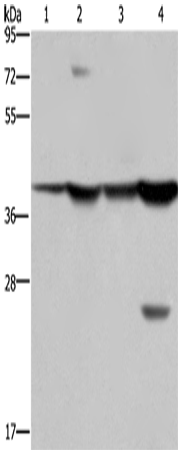 FBP1 Polyclonal Antibody (E-AB-11224)