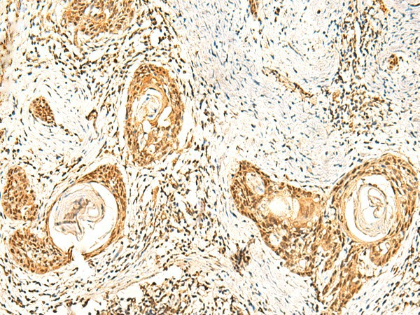 ZNF580 Polyclonal Antibody (E-AB-52825)