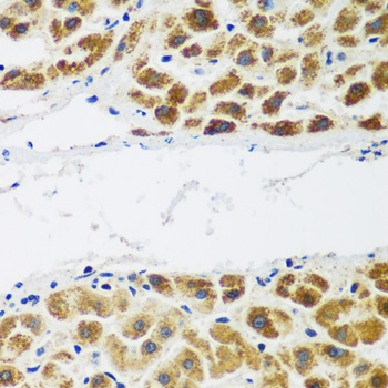 NAA60 Polyclonal Antibody (E-AB-62526)