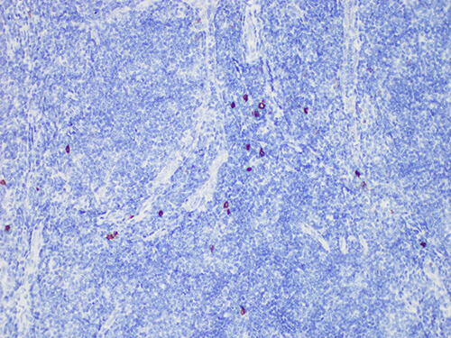 CD117/c-Kit Monoclonal Antibody (ELAB6946-M)