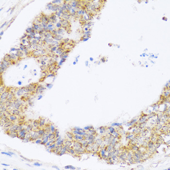 ZAK Polyclonal Antibody (E-AB-61675)