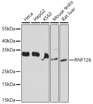 RNF126 Polyclonal Antibody (E-AB-92168)