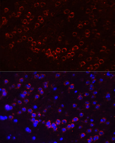 GJA1 Polyclonal Antibody (E-AB-64100)