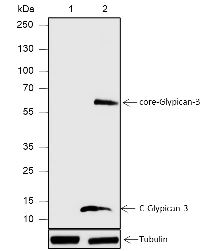 Recombinant Glypican-3 Monoclonal Antibody (AN301865L)
