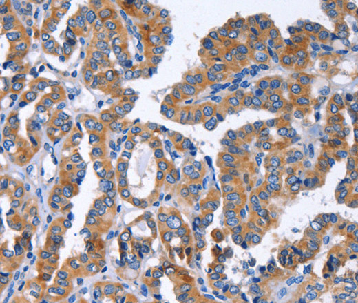 IGSF10 Polyclonal Antibody (E-AB-10389)
