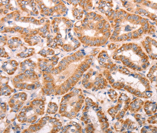TRPV4 Polyclonal Antibody (E-AB-10664)