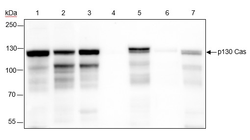 Recombinant p130 Cas Monoclonal Antibody (AN301614L)