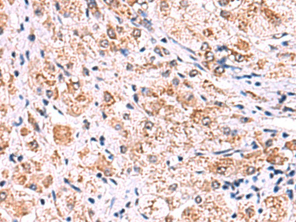 ECSIT Polyclonal Antibody (E-AB-52950)