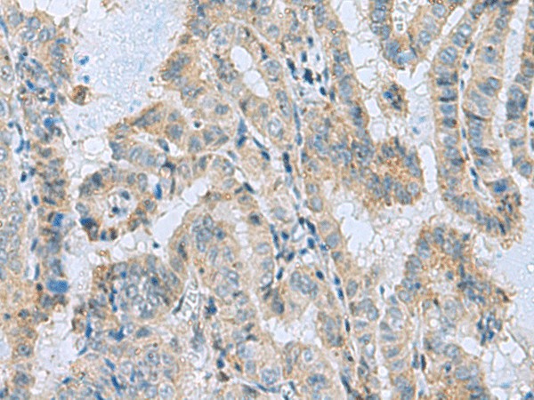 MGME1 Polyclonal Antibody (E-AB-53154)