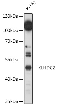 KLHDC2 Polyclonal Antibody (E-AB-93134)