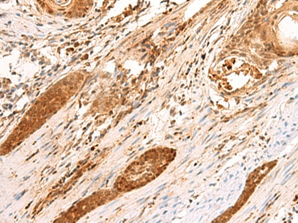 SCAND1 Polyclonal Antibody (E-AB-18920)