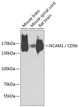 NCAM1 / CD56 Polyclonal Antibody (E-AB-62136)