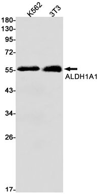 Recombinant ALDH1A1 Monoclonal Antibody (E-AB-81434)