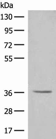 LGALS4 Polyclonal Antibody (E-AB-17982)