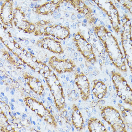 PPP2CB Polyclonal Antibody (E-AB-60851)