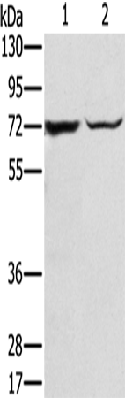 SLC25A13 Polyclonal Antibody (E-AB-15390)