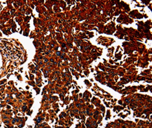 ANXA7 Polyclonal Antibody (E-AB-10045)