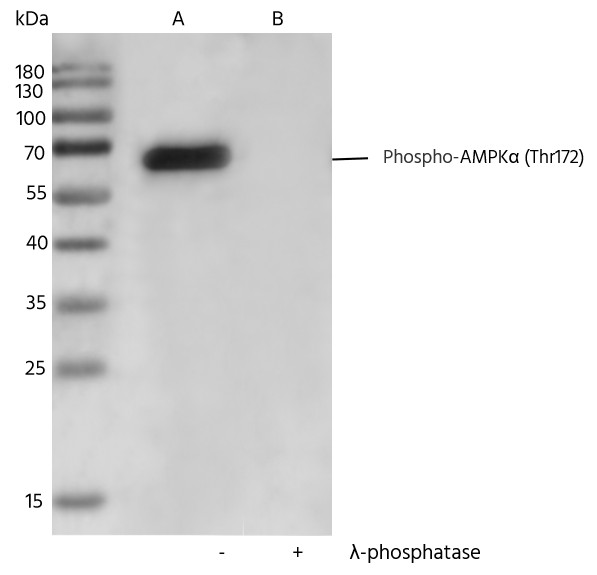 Recombinant Phospho-AMPKα (Thr172) Monoclonal Antibody (AN300369L)