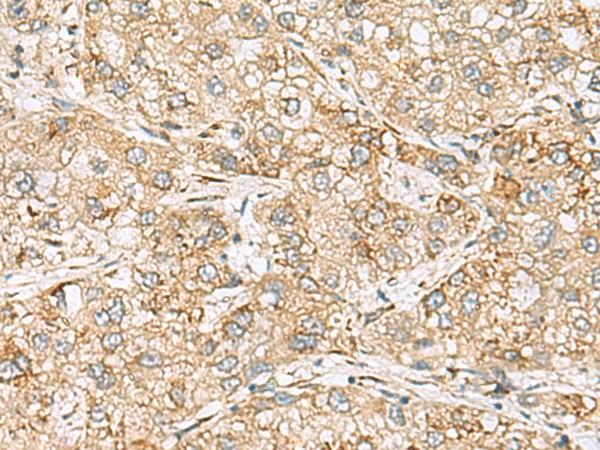 SH3GL2 Polyclonal Antibody (E-AB-18669)