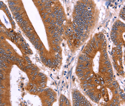 CRISP3 Polyclonal Antibody (E-AB-14895)