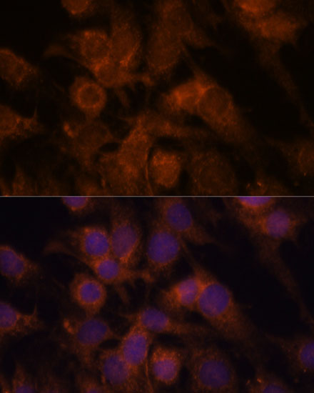 SEC23IP Polyclonal Antibody (E-AB-66478)