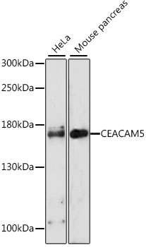 CEACAM5 Polyclonal Antibody (E-AB-60116)