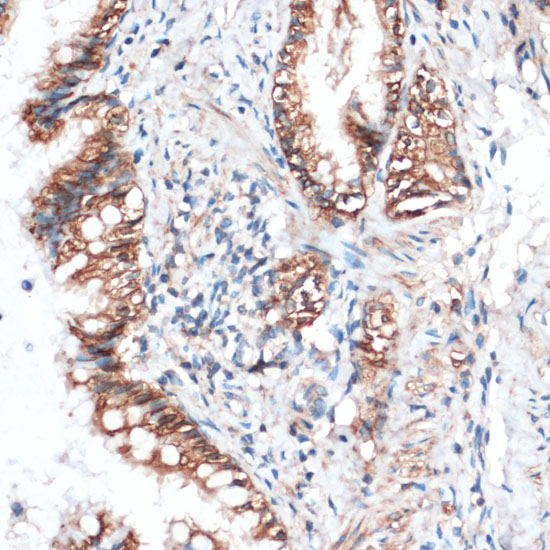 Aquaporin 4 Polyclonal Antibody (E-AB-67499)