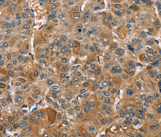 TRIP4 Polyclonal Antibody (E-AB-10962)