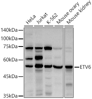 ETV6 Polyclonal Antibody (E-AB-93152)