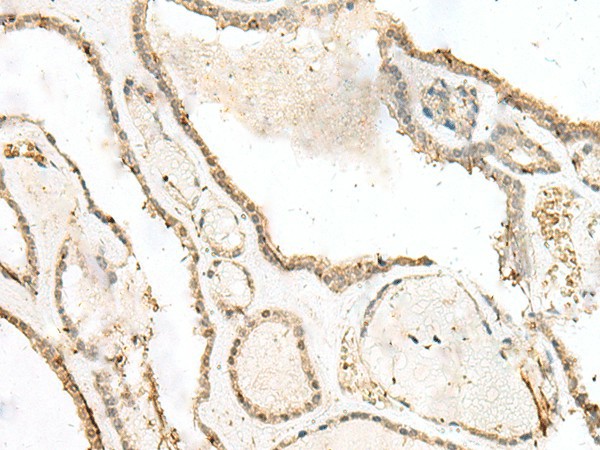 LIG4 Polyclonal Antibody (E-AB-18863)