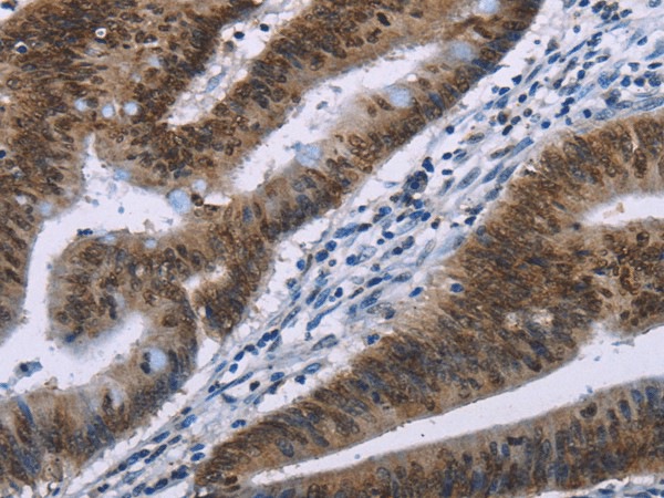 HMGA1 Polyclonal Antibody (E-AB-17331)