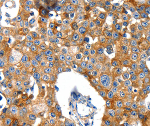 GluR2 Polyclonal Antibody (E-AB-12603)