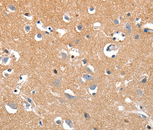 LRP3 Polyclonal Antibody (E-AB-15760)