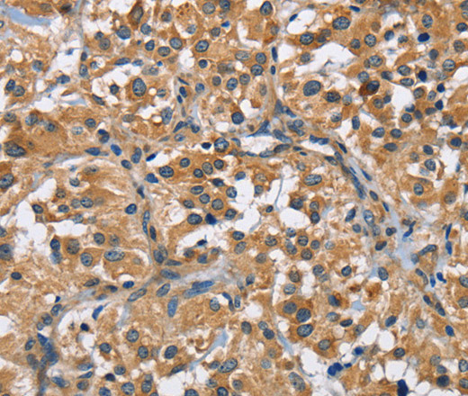 FLT3 Polyclonal Antibody (E-AB-10844)