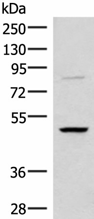 RRP8 Polyclonal Antibody (E-AB-52007)