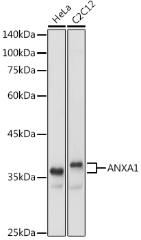 ANXA1 Polyclonal Antibody (E-AB-93042)